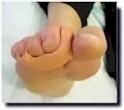 Birkoplast custom toe crest