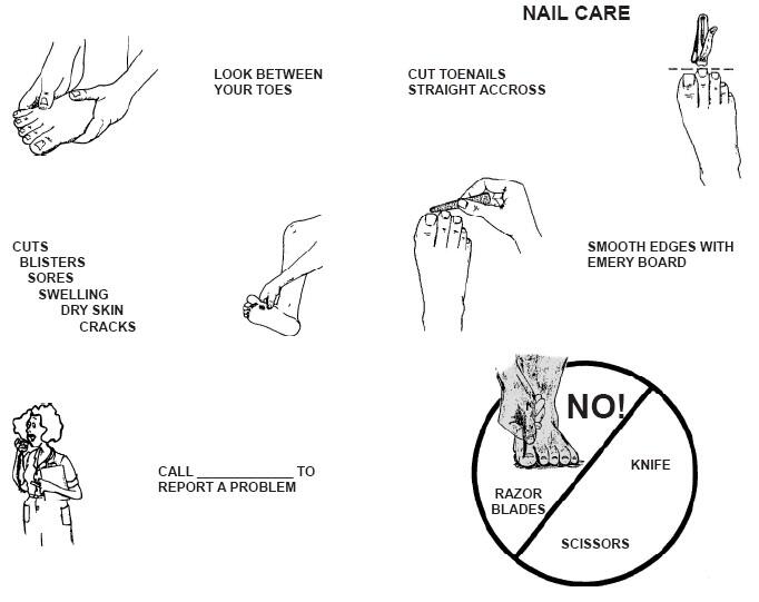 Nail care: Cut toenails straight across. Smooth the edges with an Emery board. Do Not use razor blades, scissors or knives. Check between your toes for cuts, blisters, sores, swelling, dry skin and cracks. Call your clinic to report a problem.