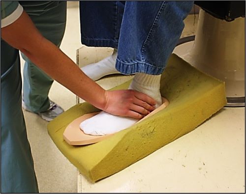 A person's foot is being fitted for an orthotic.