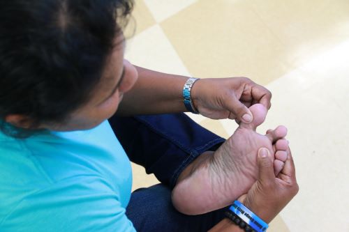  A person is performing a self inspection on their foot.
