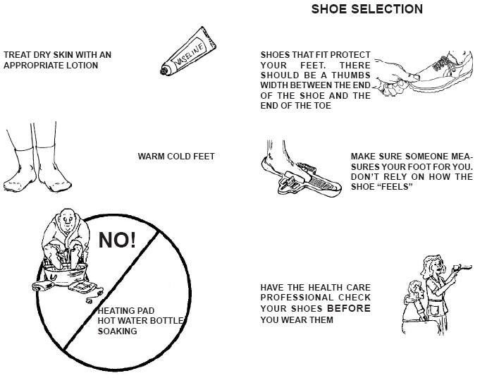 Shoe selection: wear shoes that fit your feet. There should be a thumbs' width between the end of the shoe and the end of the tow. Make sure someone measures your foot for you. Don't rely on how the shoe "feels." Have the health care professional check your shoes BEFORE you wear them. Treat skin with an appropriate lotion. Keep your feet warm using socks. DO NOT use a heating pad, hot water bottle; do not soak your feet.