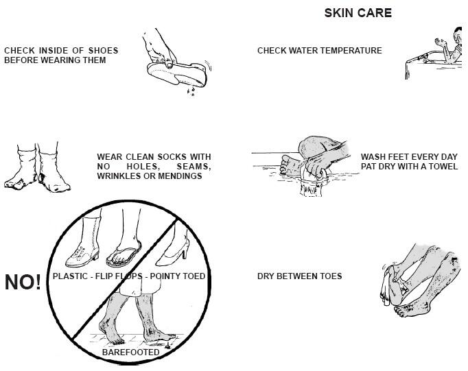 Skin care: Check bathwater temperature with elbow before using. Wash feet every day, pat dry with a towel. Dry between your toes. Check inside shoes before wearing them. Wear clean socks with no holes, seams, wrinkles or mendings. DO NOT wear plastic flip flops or pointy toed shoes. Do not walk barefooted!