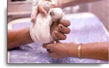 Splinting of hand wounds image.